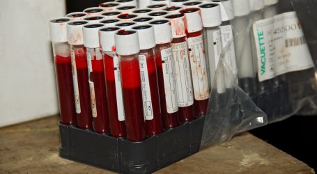 Simulationsstudie zu Notfallmaßnahmen gegen Maul- und Klauenseuche